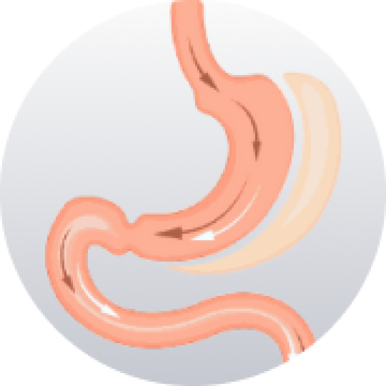 Revisions Surgeries.