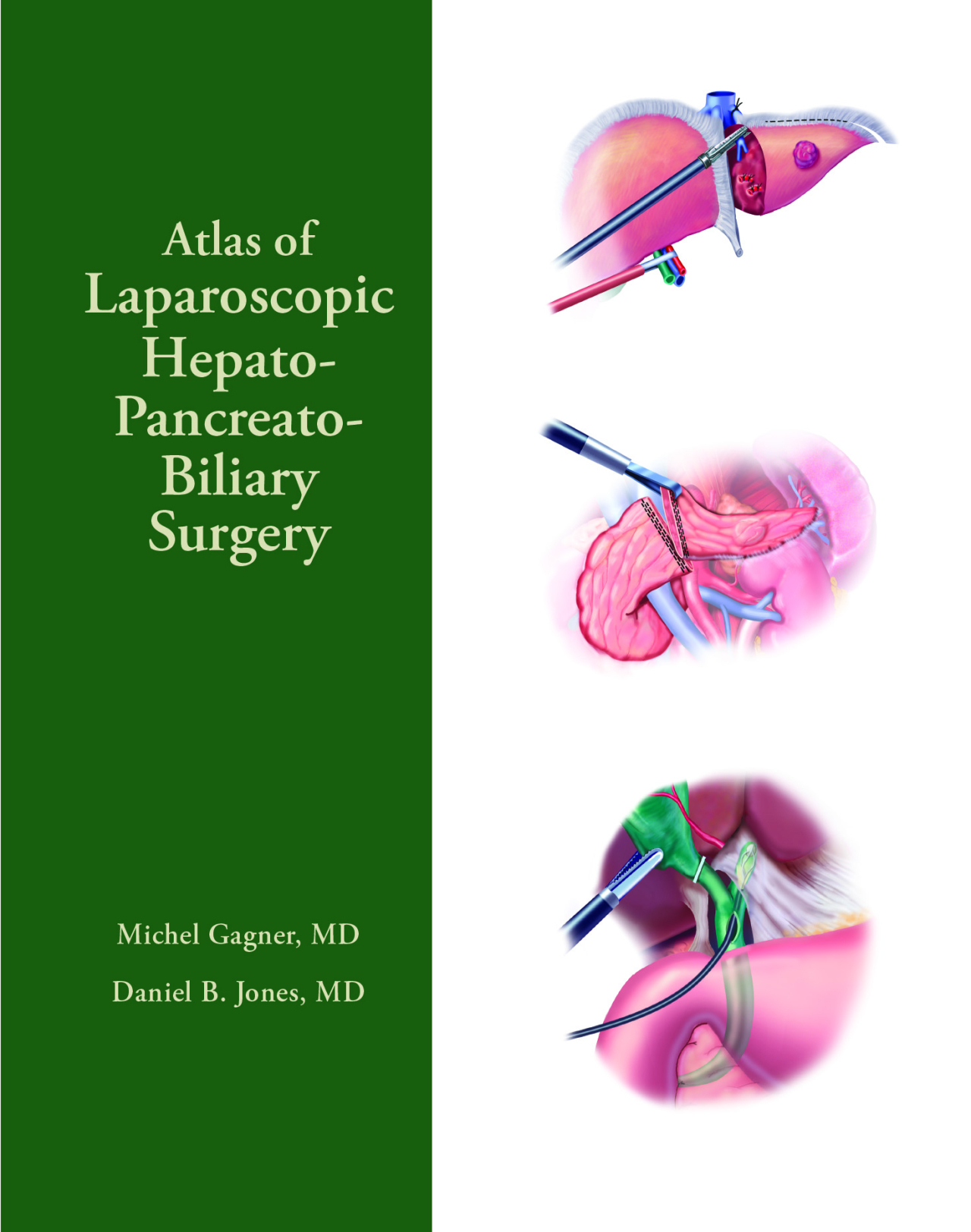 Hepato Pancreato Biliary.